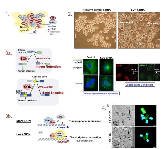 Four-panel research figure of SON protein function. Panel 1: SON and SRRM2 forming a nuclear speckle. Panel 2: micrographs comparing normal cells with SON-depleted cells that become large, round, or elongated. Panel 3a: diagrams of intron retention and exon skipping when SON is missing. Panel 3b: SON repressing the menin–MLL complex to lower H3K4 trimethylation. Panel 4: electron microscopy showing centriole and cilia defects after SON depletion.